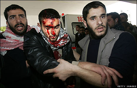 gaza-hospital-over-3000-casualties