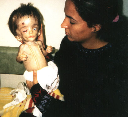 depleted uranium images. whom six were dead within